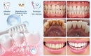 Crema Dental Reparadora Dientes con Hidroxiapatita 7.5%